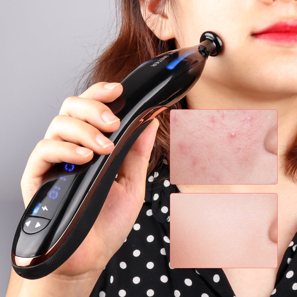 Plasma Pen Scar Acne Removal Machine Skin Lifting Shrink Pores Ozone Therapy Blue Light